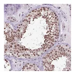 Atlas Antibodies Anti-ORC5 Antibody