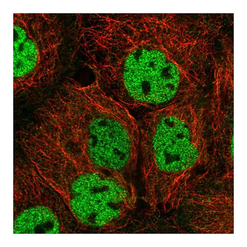 Atlas Antibodies Anti-ORAOV1 Antibody