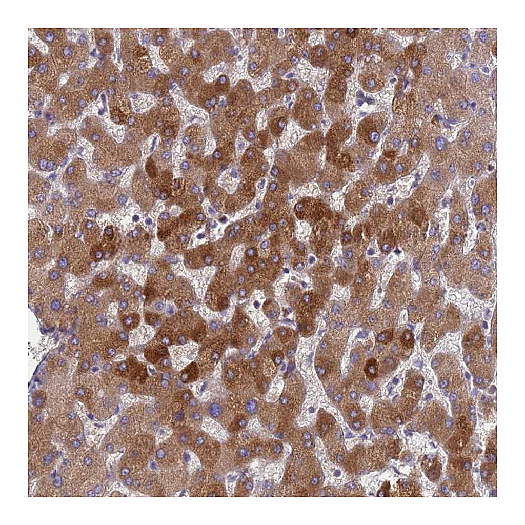 Atlas Antibodies Anti-ORM1 Antibody