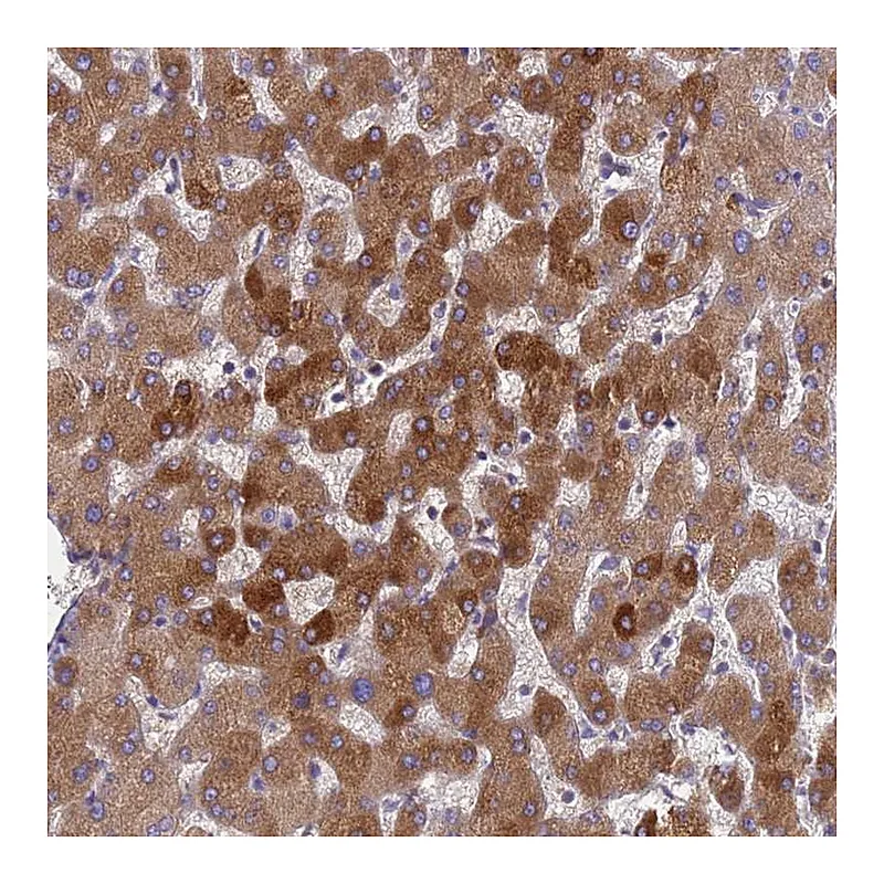 Atlas Antibodies Anti-ORM1 Antibody