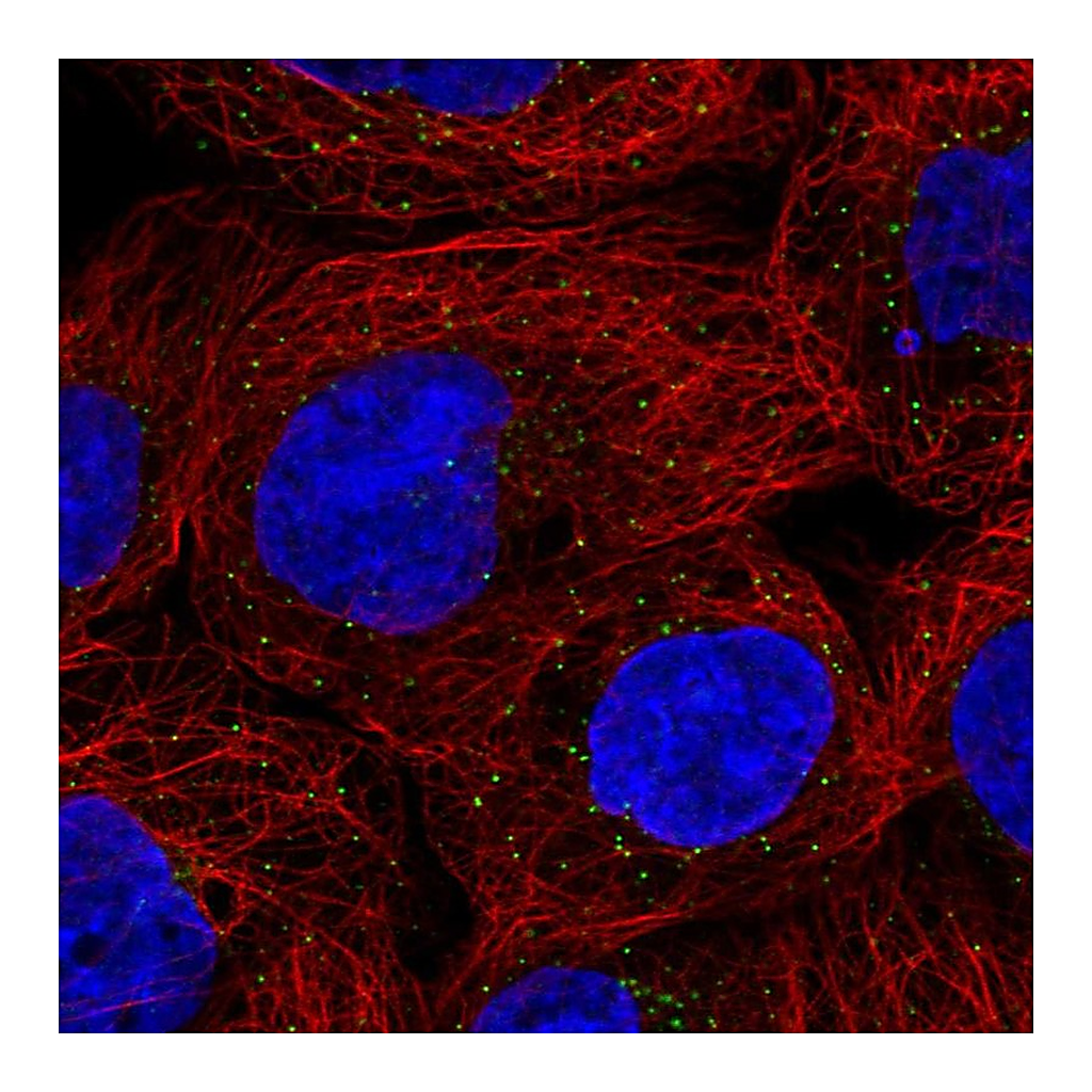 Atlas Antibodies Anti-ORM1 Antibody