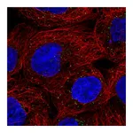 Atlas Antibodies Anti-ORM1 Antibody