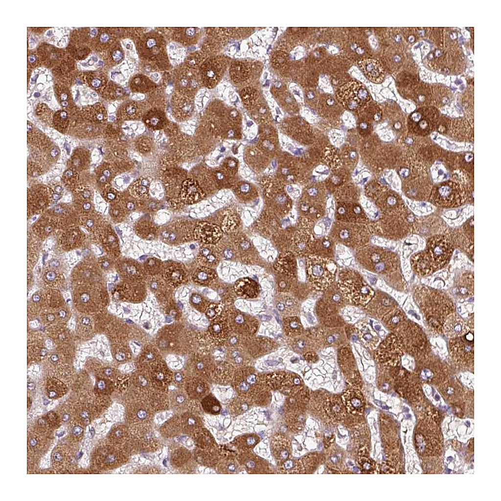 Atlas Antibodies Anti-ORM1 Antibody