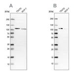 Atlas Antibodies Anti-OSBP Antibody