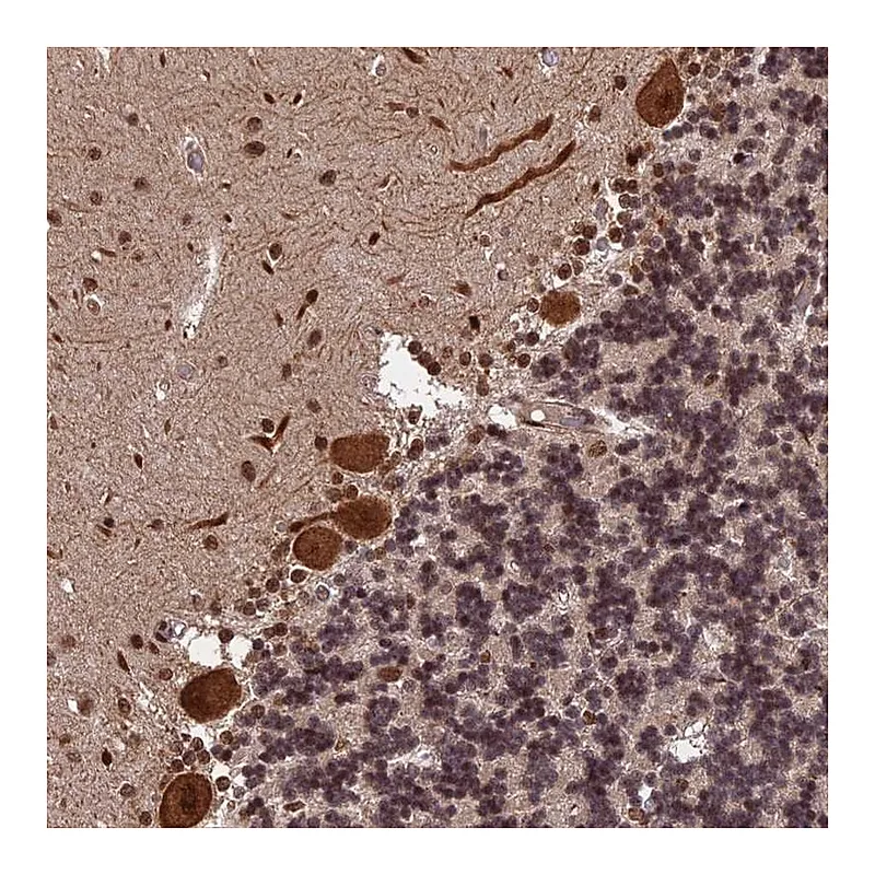 Atlas Antibodies Anti-OSBPL1A Antibody