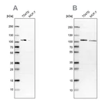 Atlas Antibodies Anti-OSBP Antibody