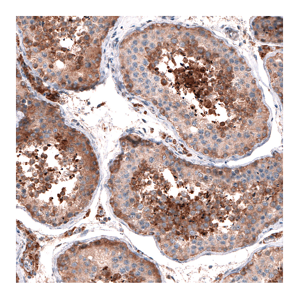 Atlas Antibodies Anti-OSBP2 Antibody