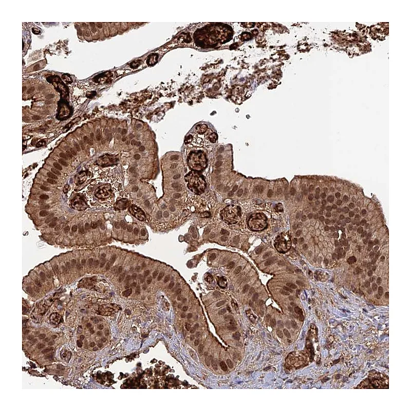 Atlas Antibodies Anti-OSBPL1A Antibody