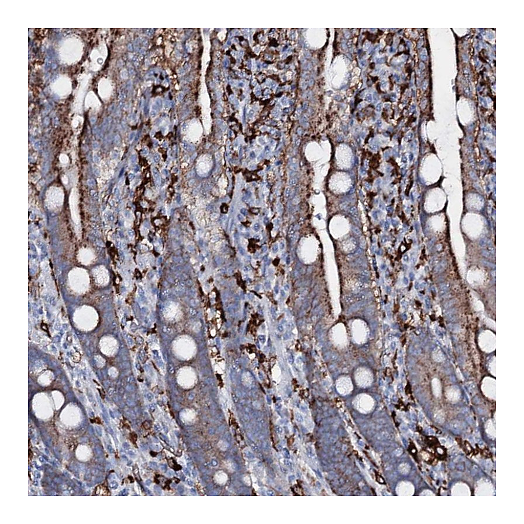 Atlas Antibodies Anti-OSBPL2 Antibody