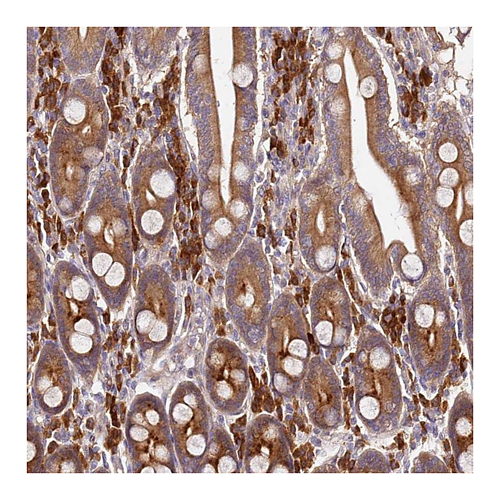 Atlas Antibodies Anti-OSBPL2 Antibody