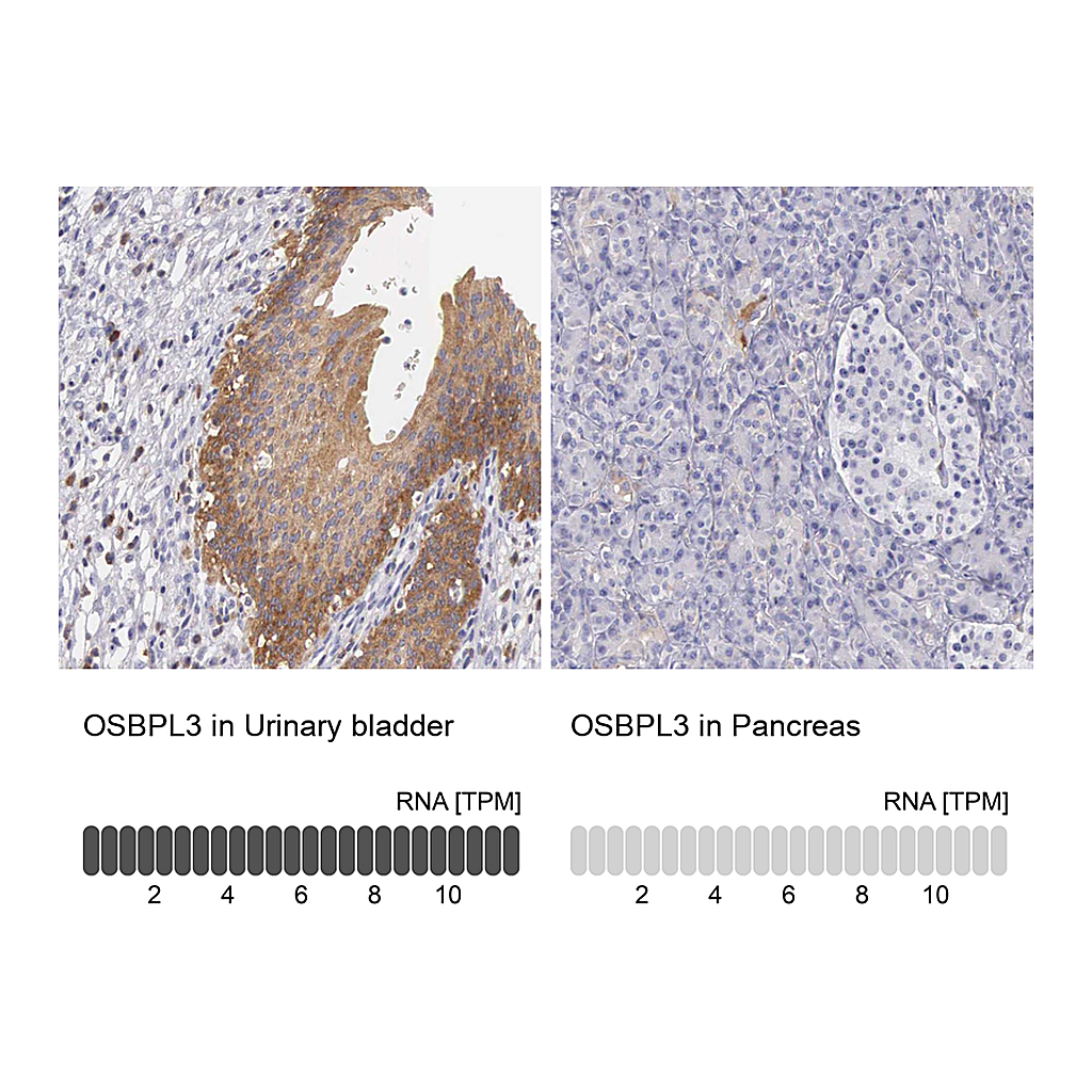 Atlas Antibodies Anti-OSBPL3 Antibody