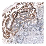 Atlas Antibodies Anti-OSBPL5 Antibody