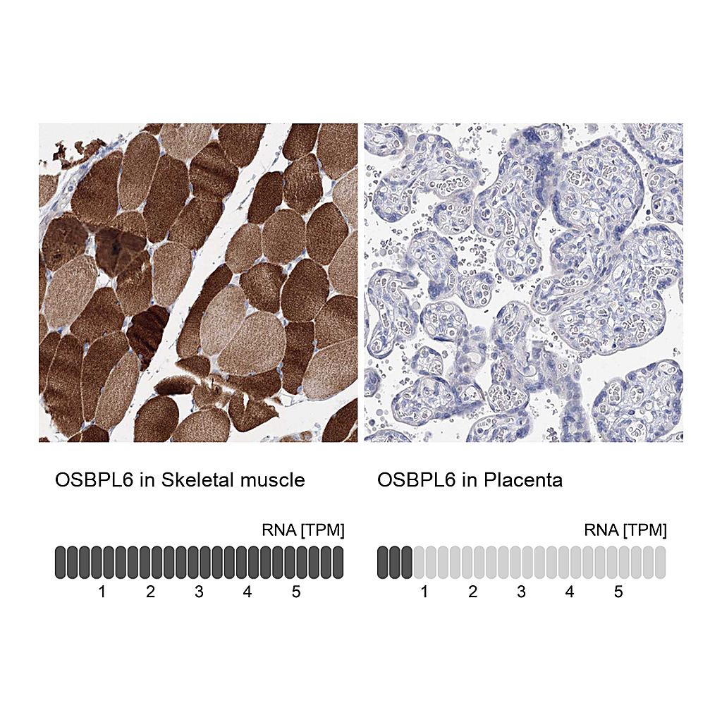 Atlas Antibodies Anti-OSBPL6 Antibody