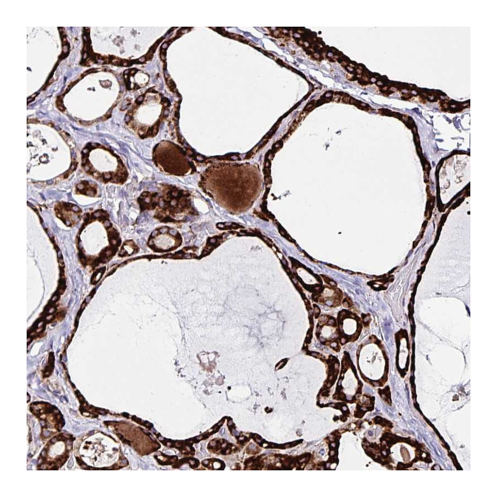 Atlas Antibodies Anti-OSBPL5 Antibody
