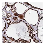 Atlas Antibodies Anti-OSBPL5 Antibody