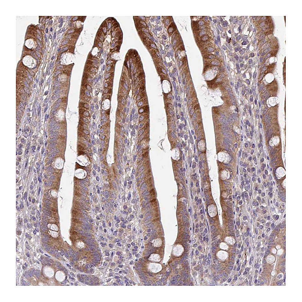 Atlas Antibodies Anti-OSBPL7 Antibody