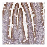 Atlas Antibodies Anti-OSBPL7 Antibody