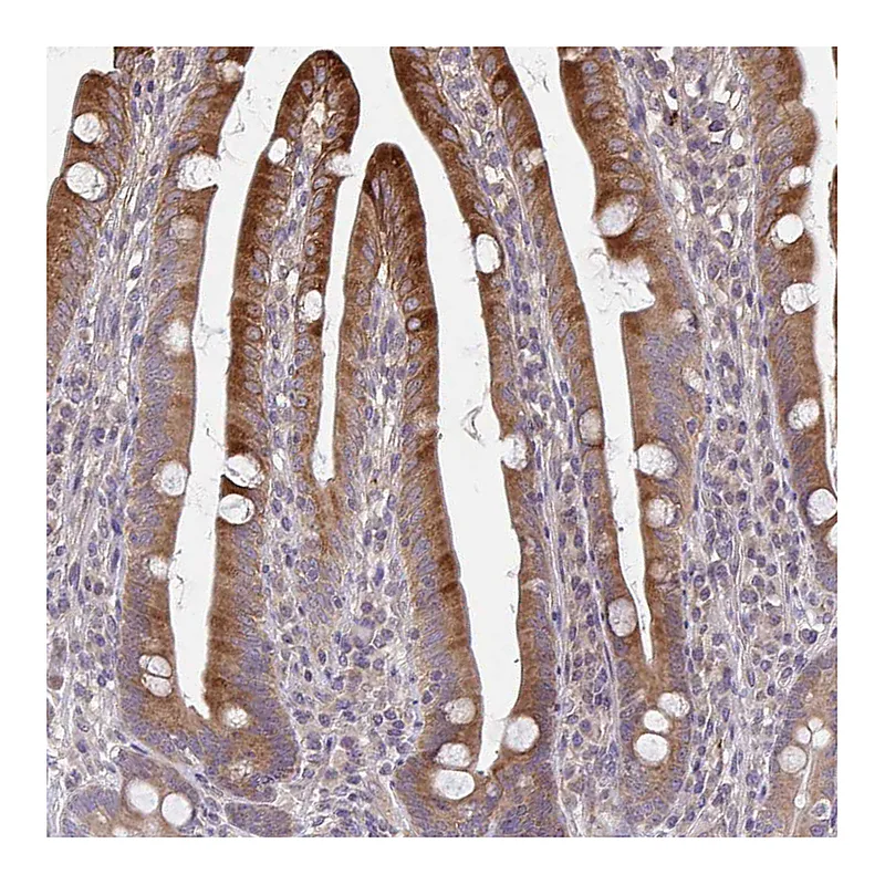 Atlas Antibodies Anti-OSBPL7 Antibody