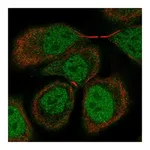 Atlas Antibodies Anti-OSBPL7 Antibody