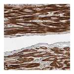 Atlas Antibodies Anti-OSBPL9 Antibody