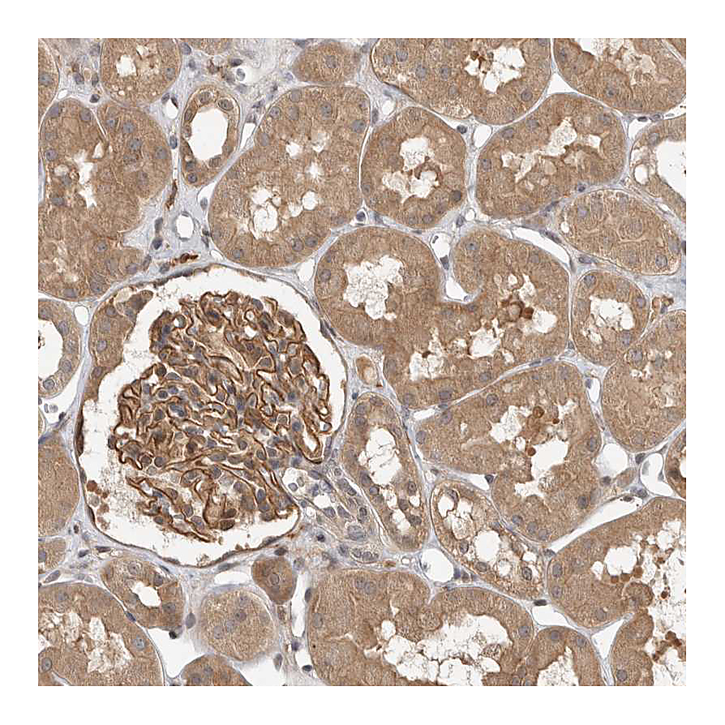 Atlas Antibodies Anti-OSBPL9 Antibody