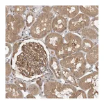 Atlas Antibodies Anti-OSBPL9 Antibody