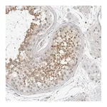 Atlas Antibodies Anti-OSCP1 Antibody