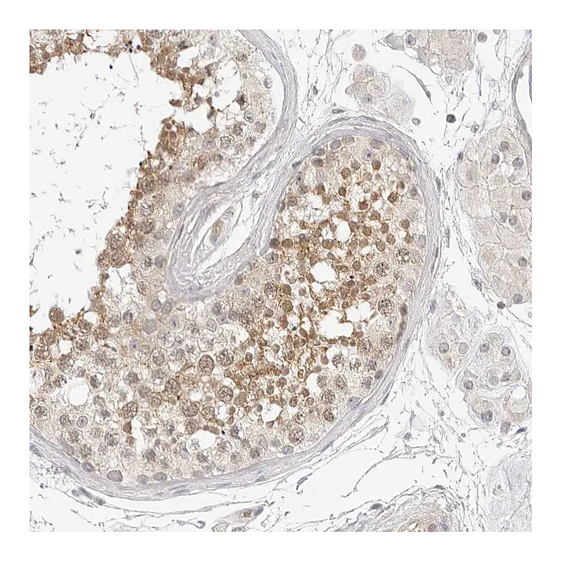 Atlas Antibodies Anti-OSCP1 Antibody