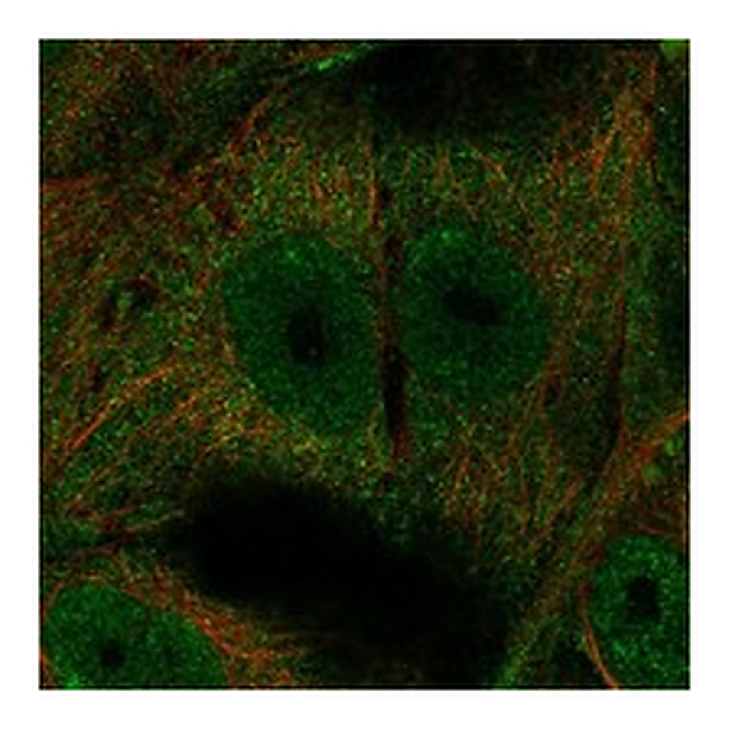 Atlas Antibodies Anti-OSCAR Antibody