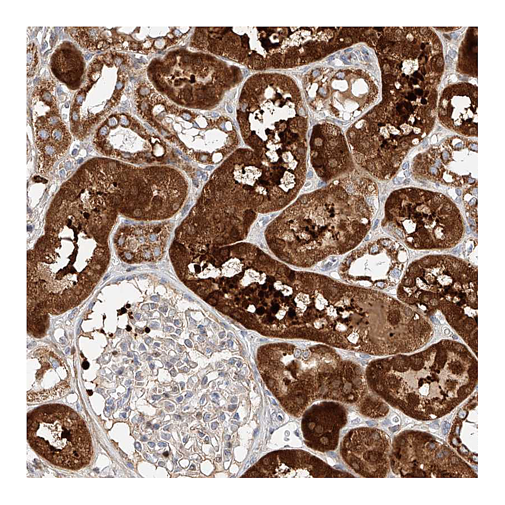 Atlas Antibodies Anti-OSGEPL1 Antibody