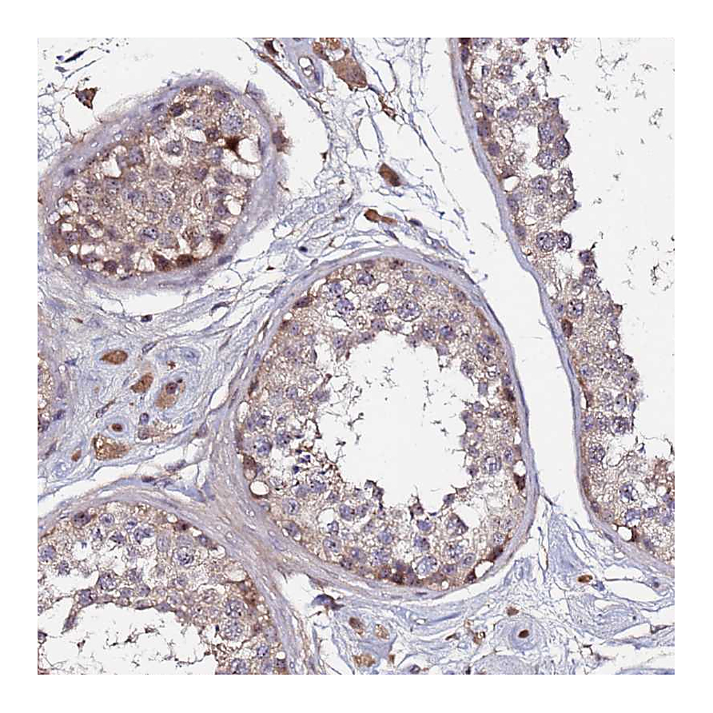 Atlas Antibodies Anti-OSER1 Antibody