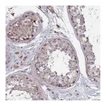 Atlas Antibodies Anti-OSER1 Antibody