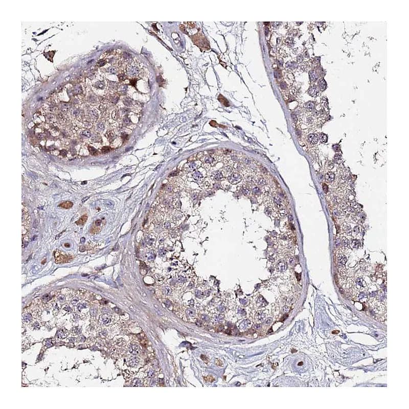 Atlas Antibodies Anti-OSER1 Antibody
