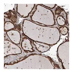 Atlas Antibodies Anti-OSGIN2 Antibody