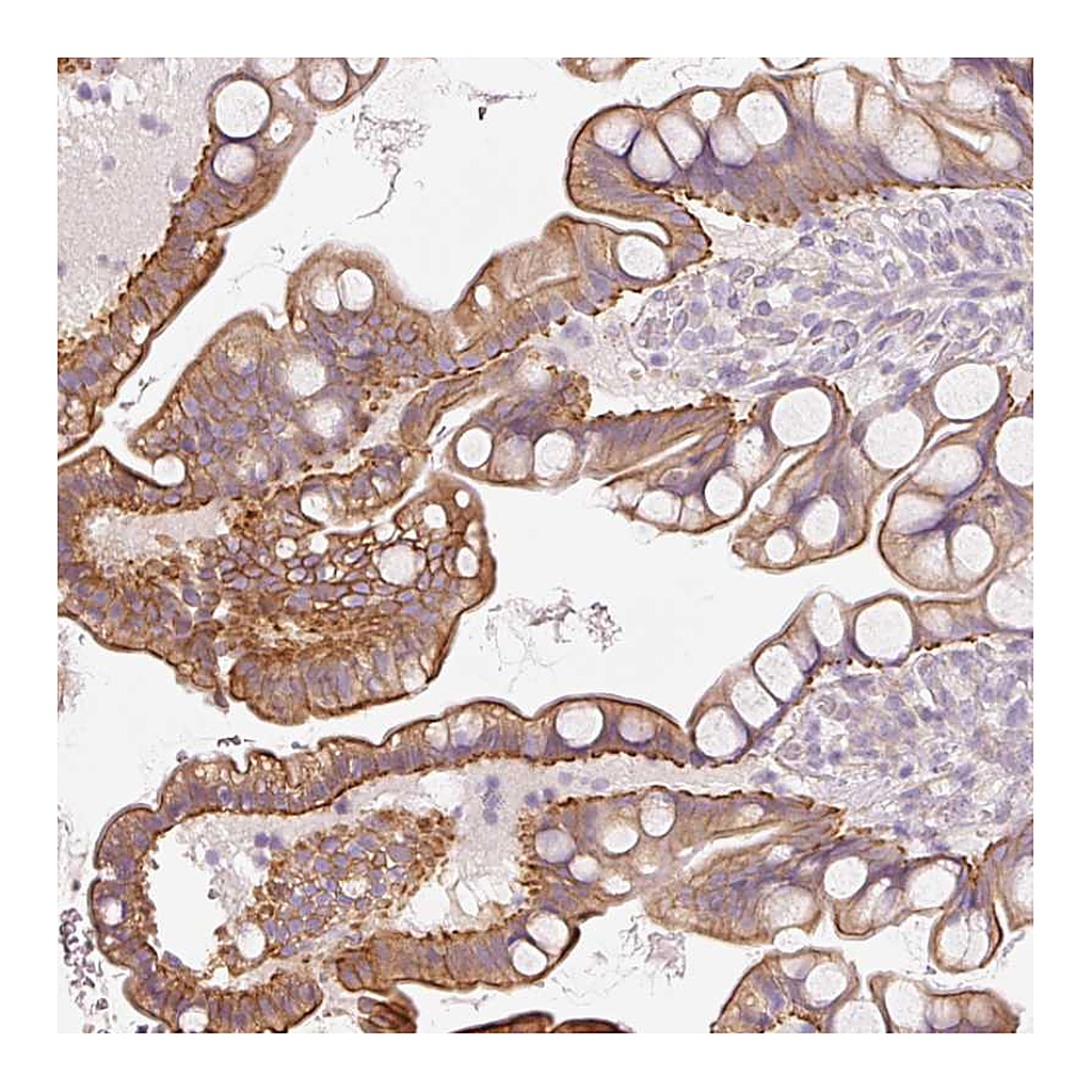 Atlas Antibodies Anti-OSR2 Antibody
