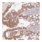 Atlas Antibodies Anti-OSR2 Antibody