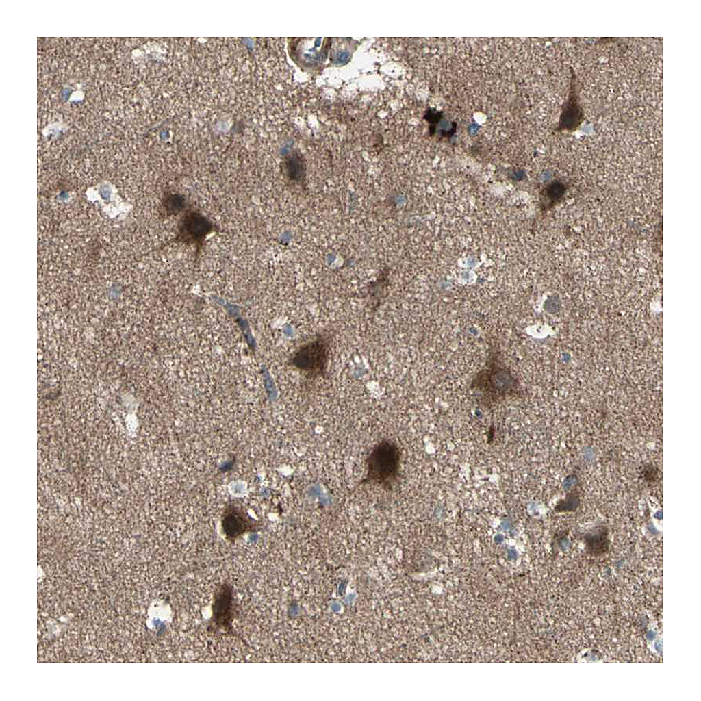 Atlas Antibodies Anti-OSTM1 Antibody
