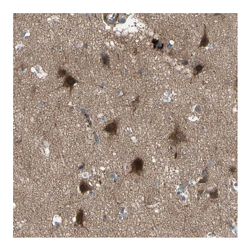 Atlas Antibodies Anti-OSTM1 Antibody