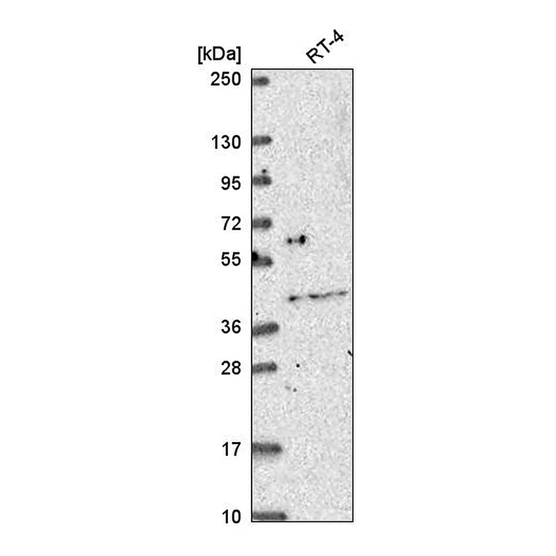 Atlas Antibodies Anti-OSR2 Antibody