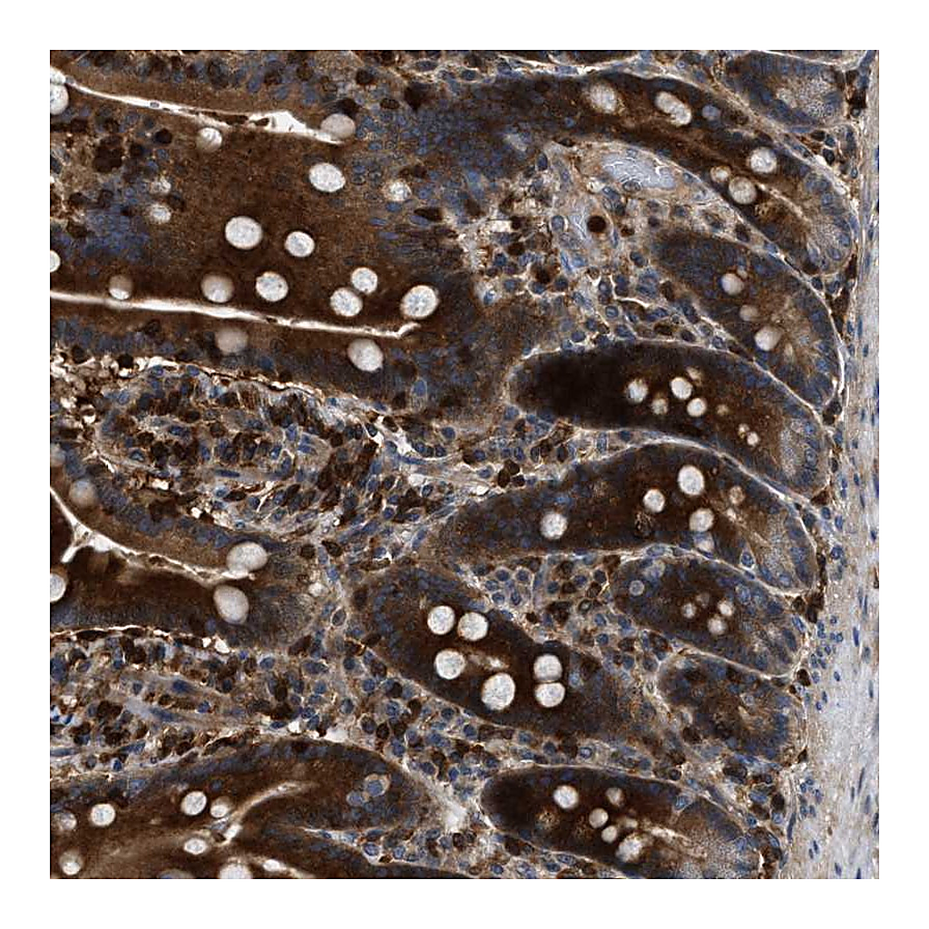 Atlas Antibodies Anti-OSTF1 Antibody