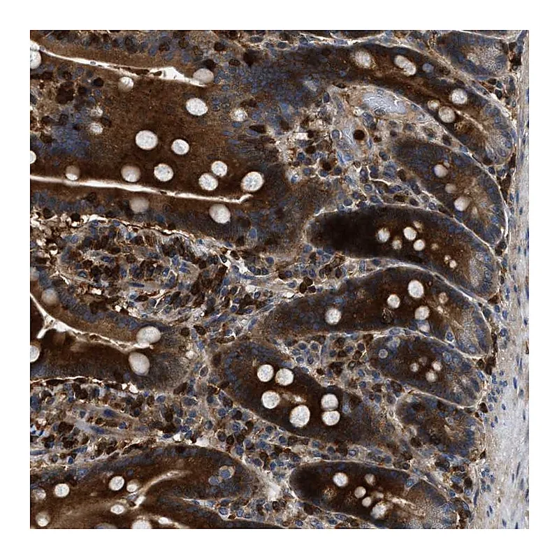 Atlas Antibodies Anti-OSTF1 Antibody