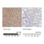 Atlas Antibodies Anti-OTC Antibody