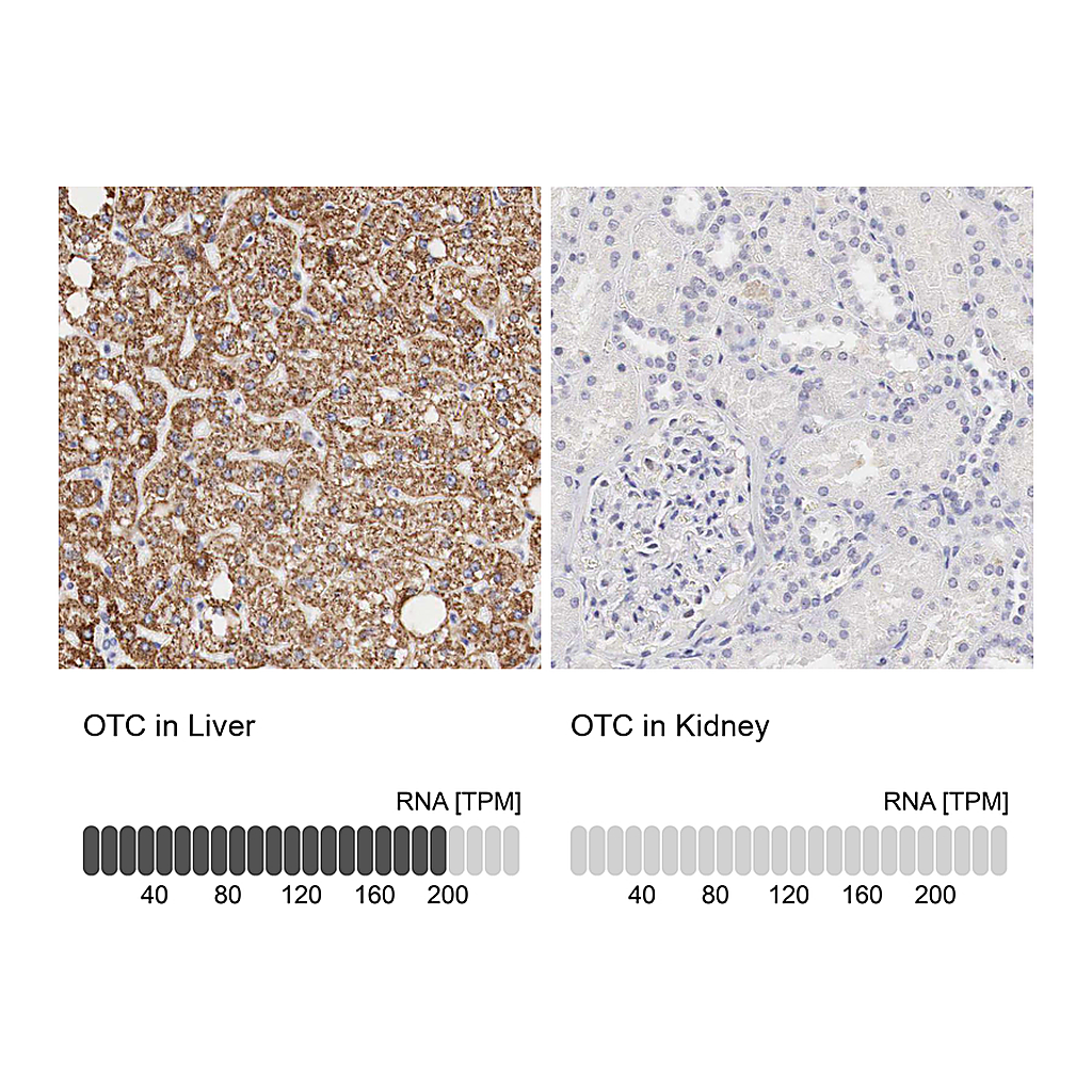 Atlas Antibodies Anti-OTC Antibody