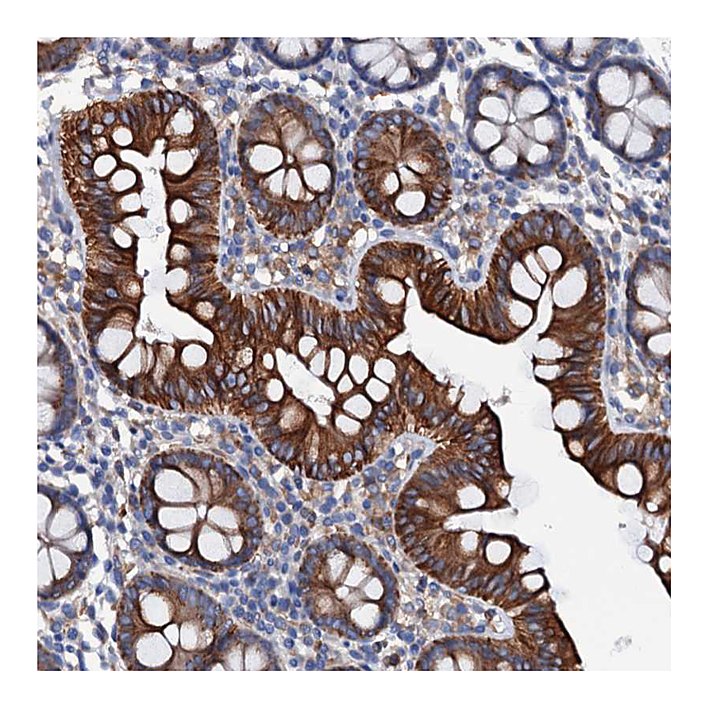 Atlas Antibodies Anti-OTOL1 Antibody