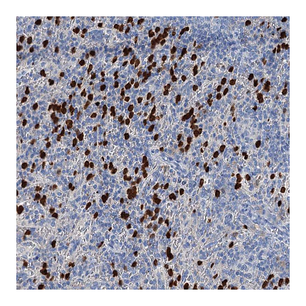 Atlas Antibodies Anti-OTOA Antibody