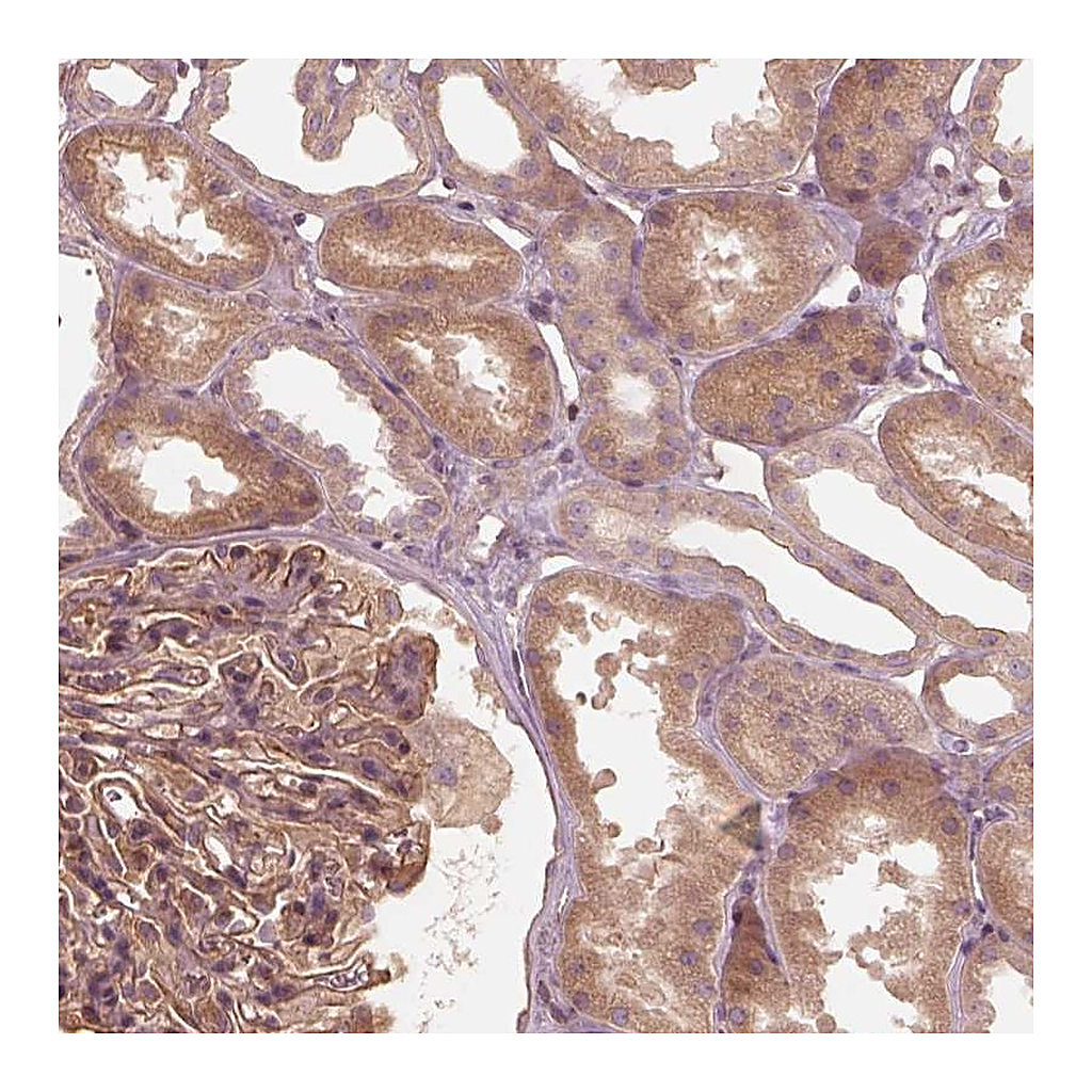 Atlas Antibodies Anti-OTOGL Antibody