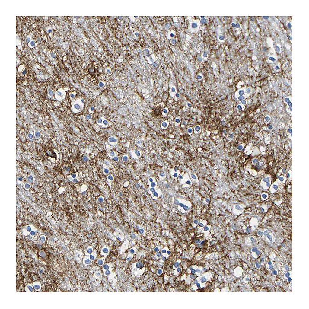 Atlas Antibodies Anti-OTOF Antibody