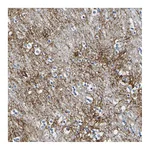 Atlas Antibodies Anti-OTOF Antibody