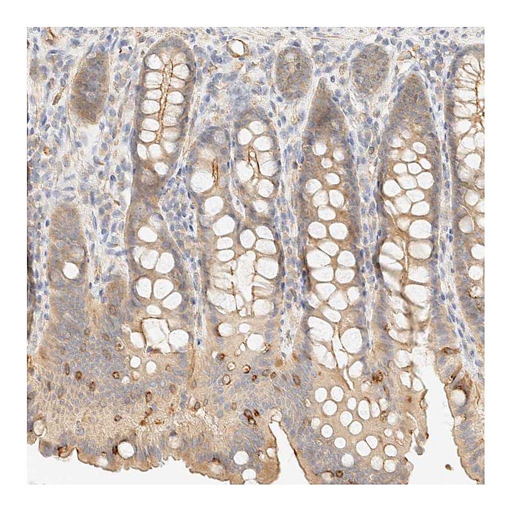 Atlas Antibodies Anti-OTOP2 Antibody