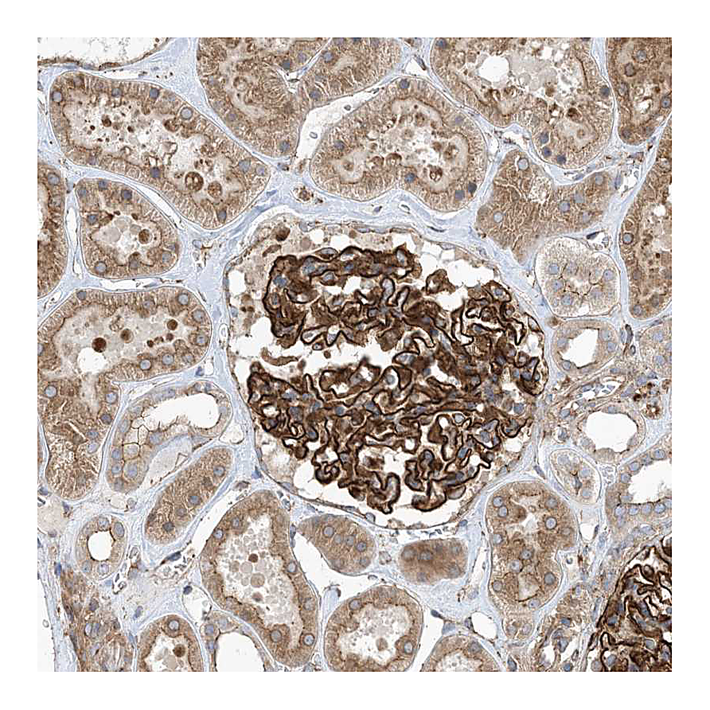 Atlas Antibodies Anti-OTOP1 Antibody